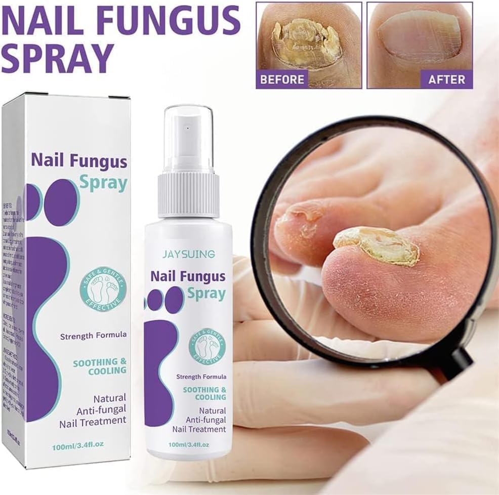 Healthy Nail Repair & Fungus Spray