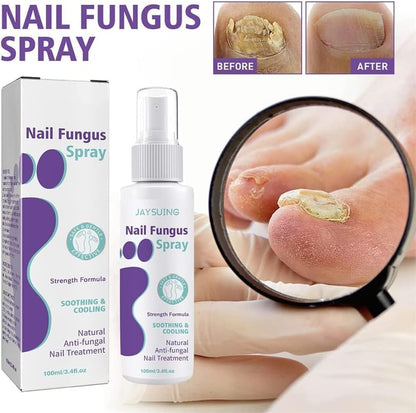 Healthy Nail Repair & Fungus Spray