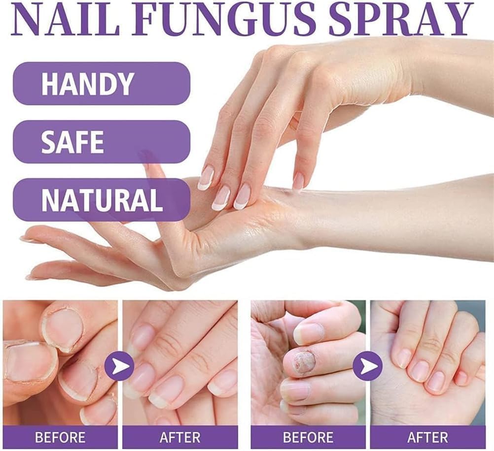 Healthy Nail Repair & Fungus Spray