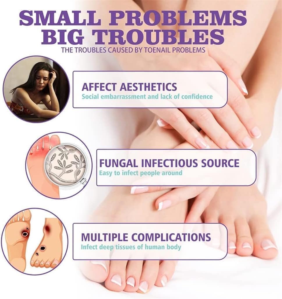 Healthy Nail Repair & Fungus Spray