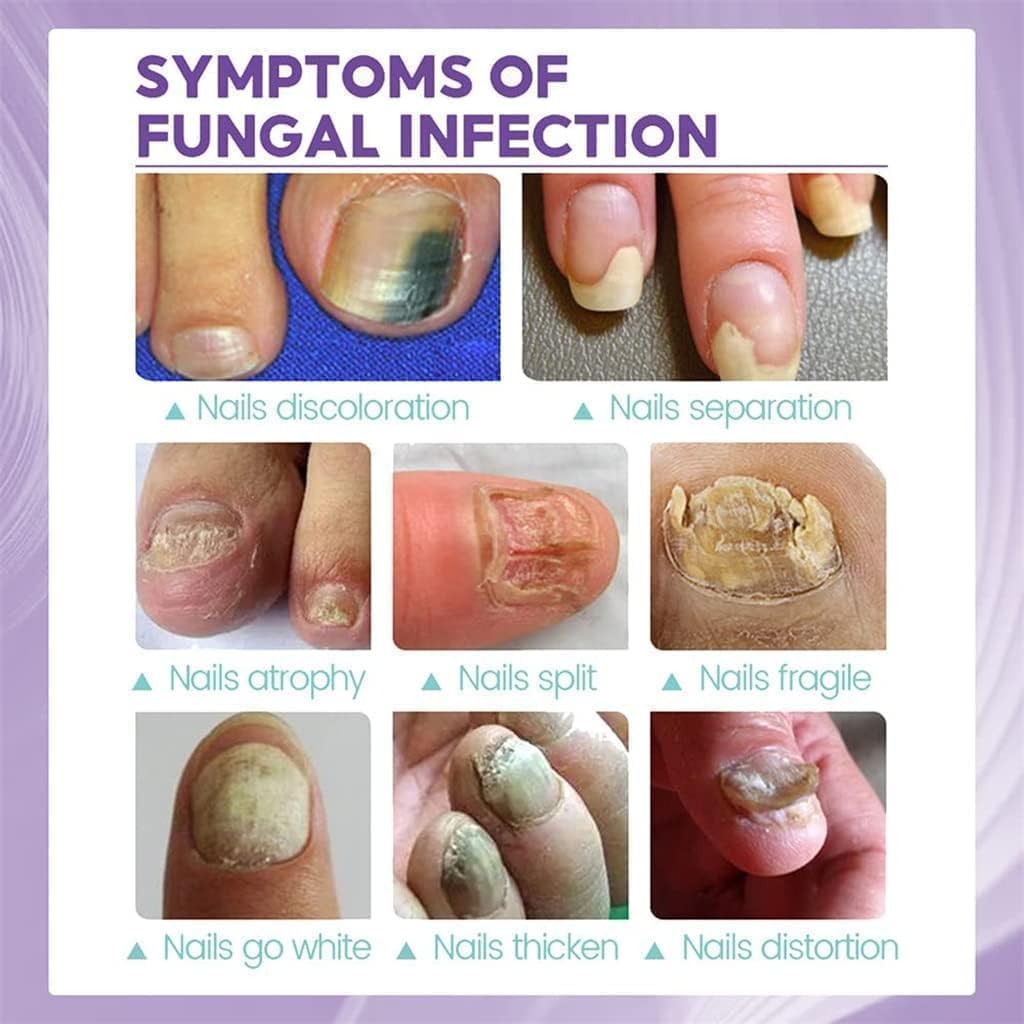 Healthy Nail Repair & Fungus Spray
