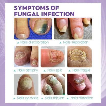 Healthy Nail Repair & Fungus Spray