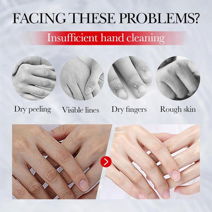 Kojic Acid Hand Cream — Brightening & Hydration