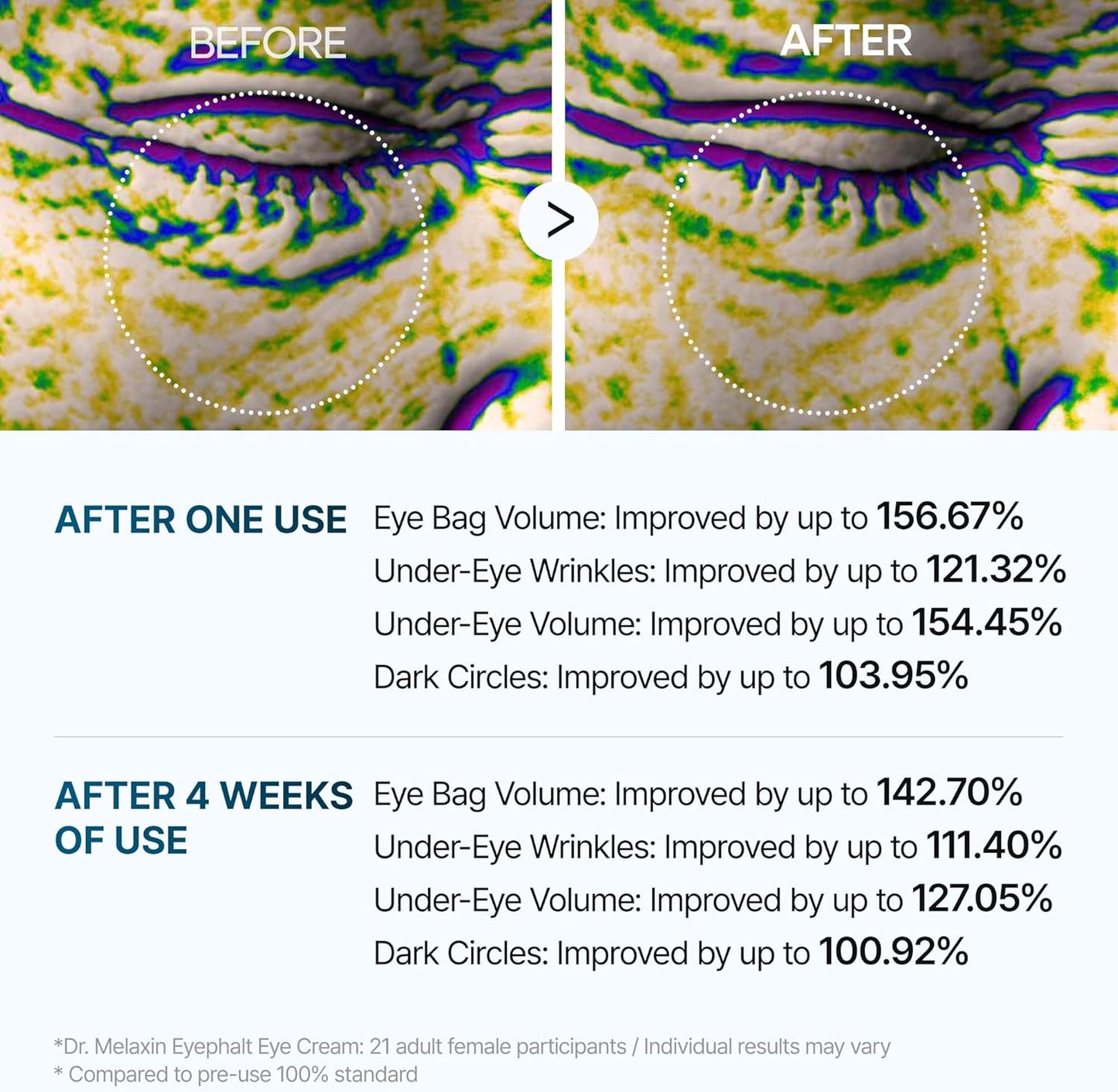 Eye Bag Renewal Cream — Dark Circles