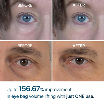 Eye Bag Renewal Cream — Dark Circles